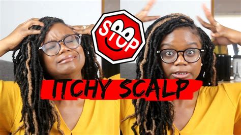 How To Stop An Itchy Scalp While Protective Styling Youtube