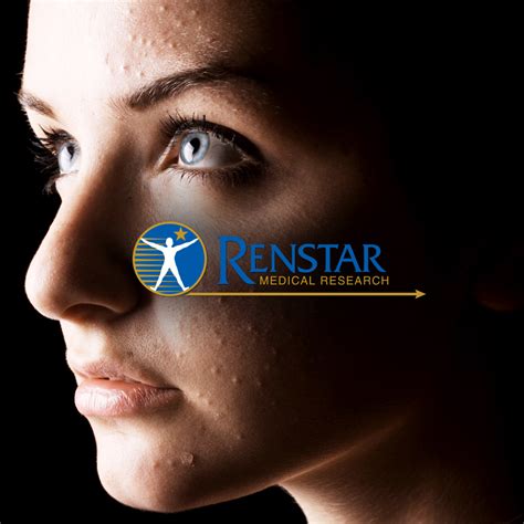 Renstar Medical Research Trial Post Acne 2 Renstar Medical Research