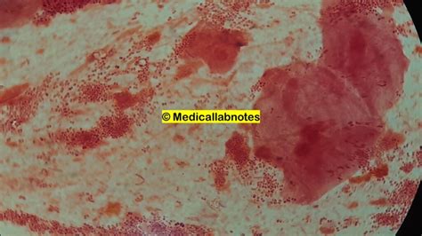 Streptococcus Oralisintroduction Morphology Pathogenicity