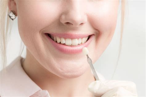 All About Cosmetic Dental Contouring Aka Tooth Reshaping With