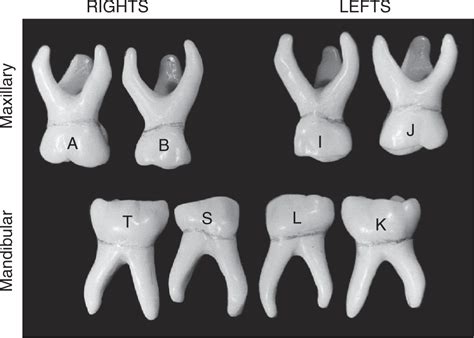 Class And Type Traits Of Primary Molars Pocket Dentistry