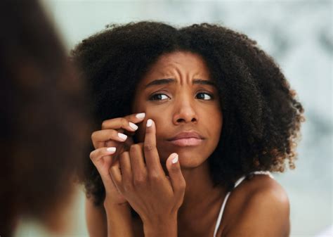 5 Cosmetic Products To Treat Acne And Dark Marks For People Of Color