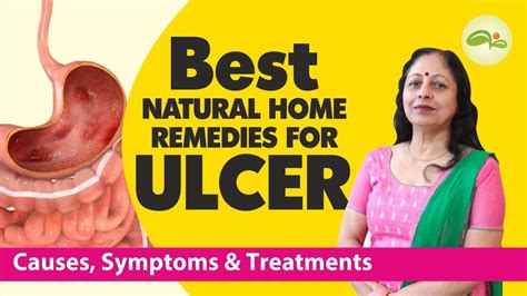 Ulcer Treatment Home Remedies Foods To Cure Stomach Ulcer Home