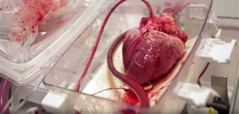 Find over 100+ of the best free real heart images. Revolutionary Machine Brings Dead Hearts Back to Life