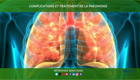 Complications Et Traitement De La Pneumonie Salem Diagnostics