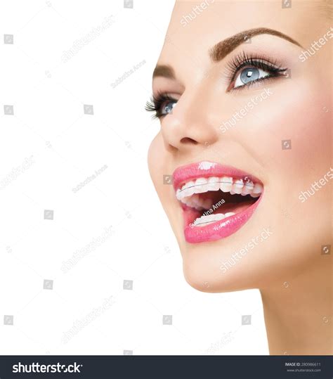 Braces Beautiful Woman Smile Close Up Healthy Smile Closeup Ceramic Braces On Teeth