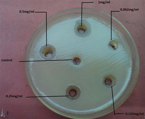 A Nutrient Agar Plates Showing Zone Of Inhibition Of Agnps Against E