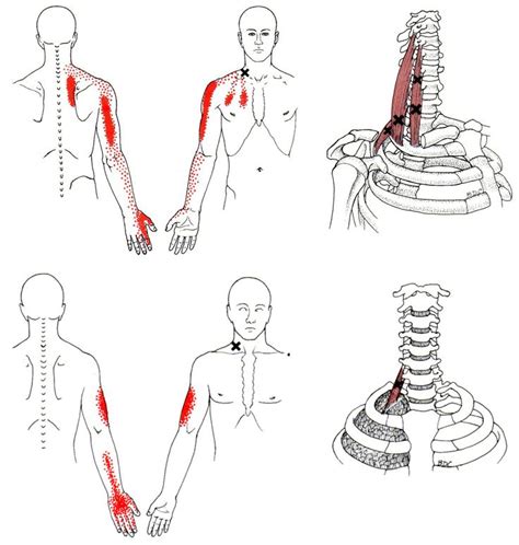 The muscular system is made up of specialized cells called muscle fibers. 173 best ASSESSMENTS AND MUSCLE TESTING images on Pinterest | Physical therapy, Trigger points ...