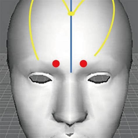 Postoperative Frontal View After Years Full Thickness Nasal Defects