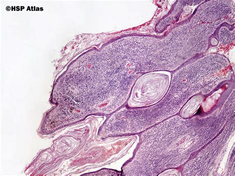 Hsp Atlas Histopathology Atlas Skin