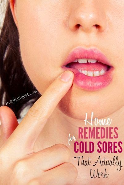 Home Remedies For Cold Sores That Actually Work Holistic Squid Cold