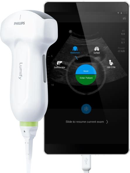 Lumify Philips Healthcare