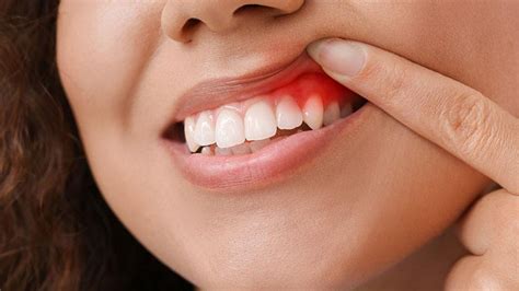 10 Possible Reasons For Your Gum Pain Page 2 Entirely Health