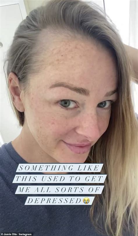 Married At First Sight Star Jamie Otis Speaks Out About Postpartum Hair Loss