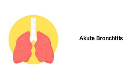Bronchitis Symptome So Erkennen Sie Eine Bronchitis