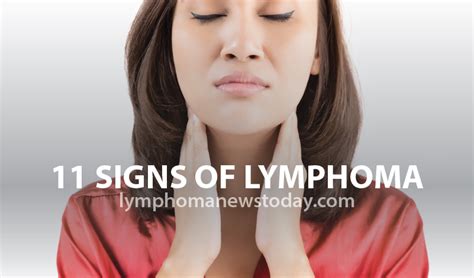 What Is Lymphoma Signs And Symptoms Siawht