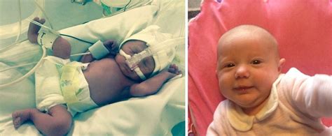 The Transformation Of These Preemie Babies Is Incredible Babycentre