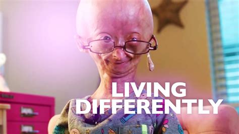 Bbc Iplayer Living Differently Series 4 1 Our Girl Who Ages Too Fast