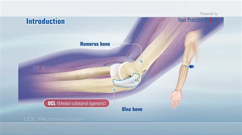 Ulnar Collateral Ligament Rehabilitation