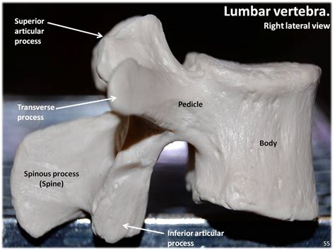 Lumbar Vertebra Lateral View With Labels Axial Skeleton Flickr