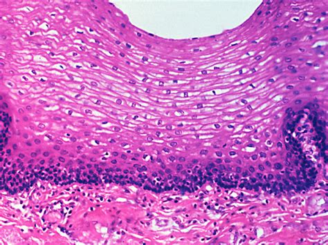 Stratified Squamous Epithelium Consists Of Cells Arranged In Multiple