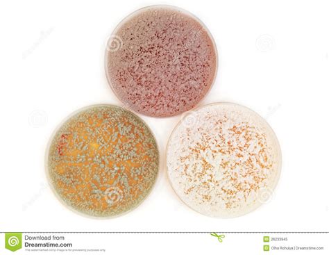 Different Fungi Microorganisms On Agar Plate Stock Image Image Of