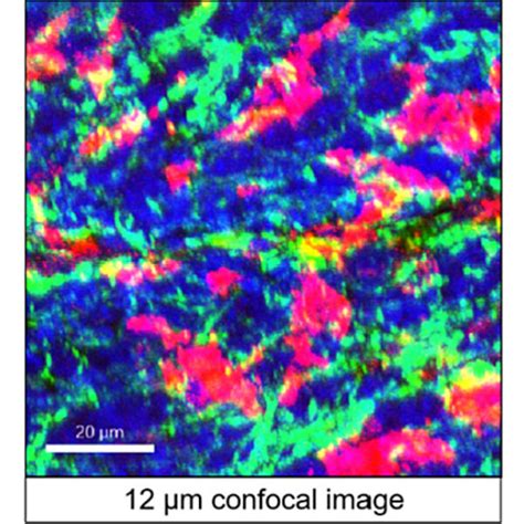 Sinus Network Of A Human Lymph Node Visualized By Confocal Microscopy