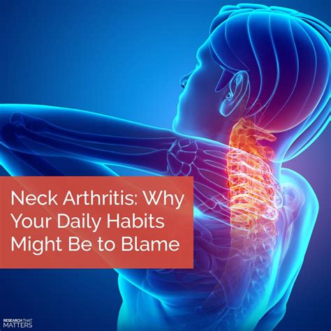 Neck Arthritis Why Your Daily Habits Might Be To Blame Sundial Clinics