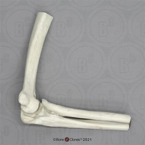 Human Elbow Joint Bone Clones Inc Osteological Reproductions