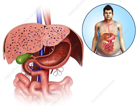 Download human internal organ images and photos. Human internal organs, illustration - Stock Image - F013 ...
