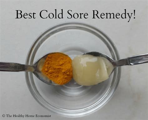 Effective Home Remedies For Cold Sores Healthy Home Economist Radio Integracion