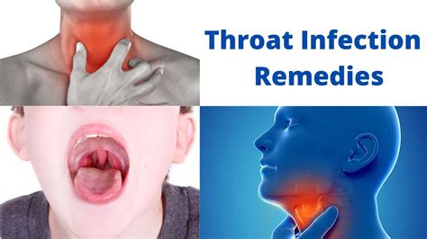 Causes Of Throat Infections