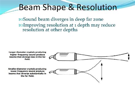 Ultrasound Physics Image Formation 97 Sound Beam Formation