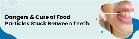 5 Dangers Of Stuck Food Particles Between Teeth Ways To Remove It