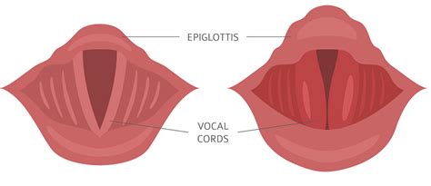 Vocal Nodules Causes Treatment And Prevention Heart Sense