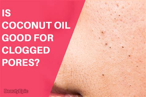 Does Coconut Oil Clog Your Pores ~
