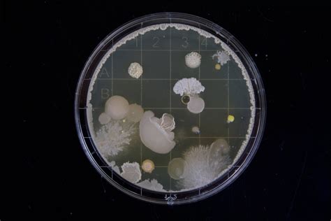There's a new bug in town, a superbug that can spread rapidly. Bakteria New Delhi - co to za bakteria? Sprawdź koniecznie ...