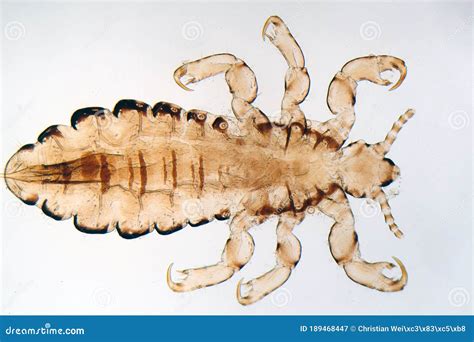 Head Louse Pediculus Humanus Under The Microscope Royalty Free Stock