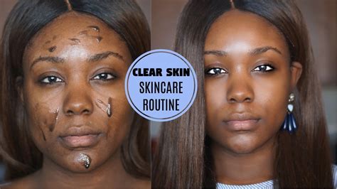 Skin Care Routine For Dark Spots Nuevo Skincare