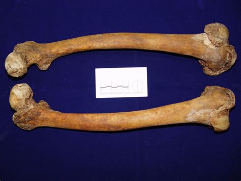 Researchers Find A Clue In Femurs For Estimating Weight The New York