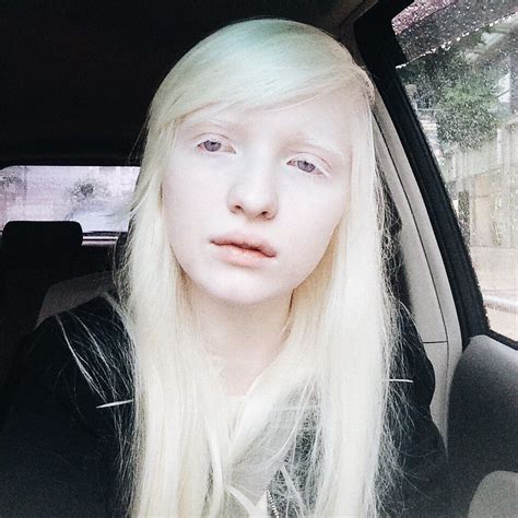 Https Twitter Com Albinonastya Albino Girl Albino Model Albino