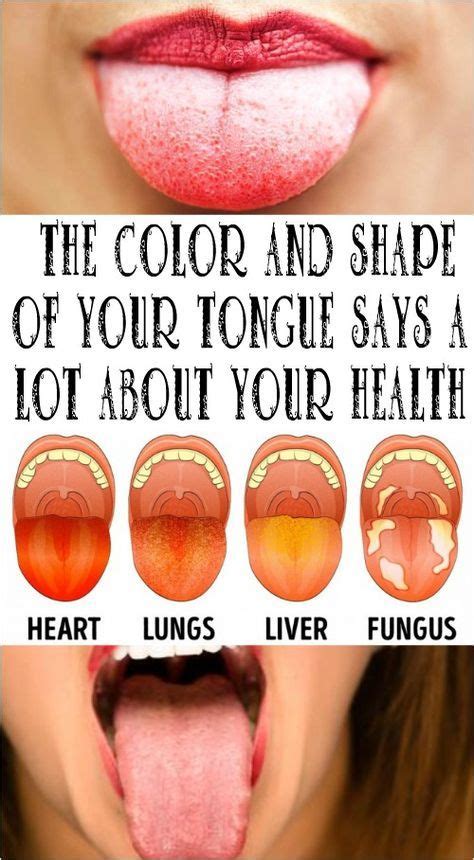 Liver Disease And Tongue