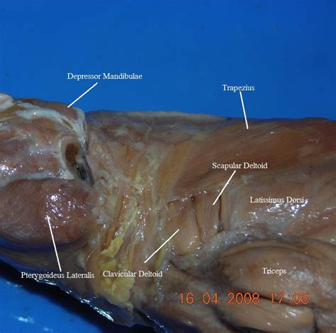 There are anterior muscles diagrams and posterior muscles diagrams. Head