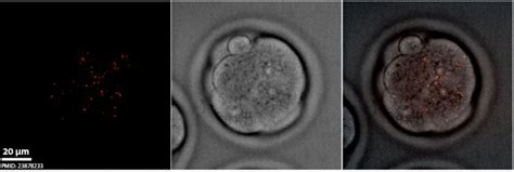 Mouse Spermatozoa Mitochondria Movie Embryology