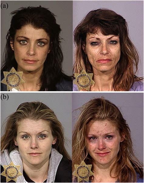 Methamphetamine Before And After
