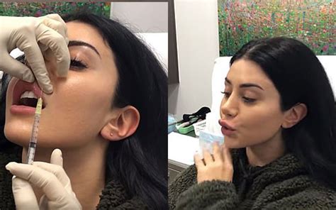 Mafs Martha Kalifatidis Fixes Her Botched Lips After Denying Ever