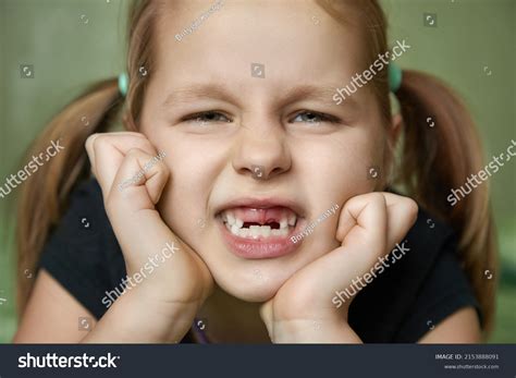 Portrait Girl Bad Teeth Her Front Stock Photo 2153888091 Shutterstock
