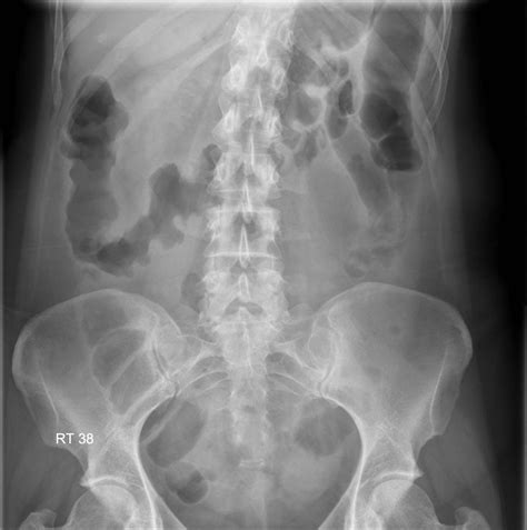 Pin on Radiology