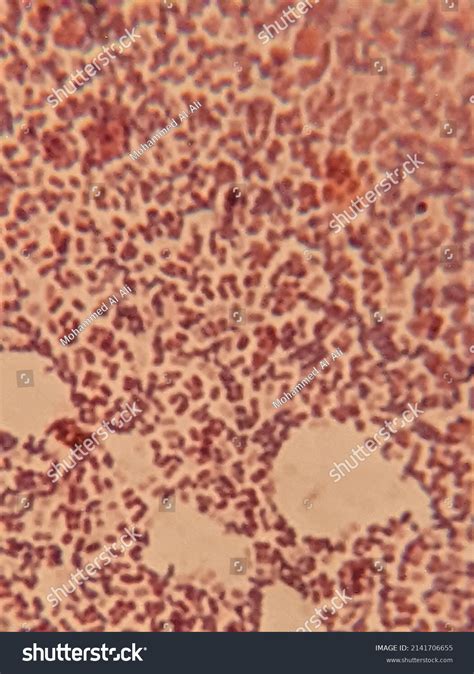 Photo Bacterial Cells Under Microscope Stock Photo 2141706655