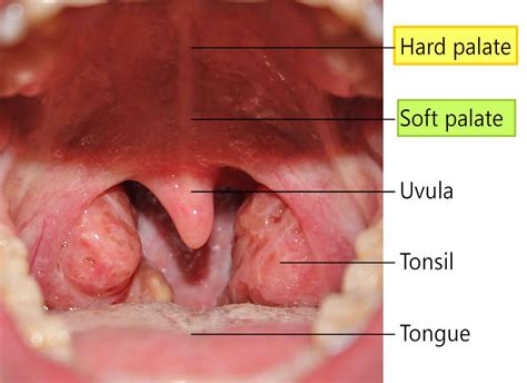 Roof Of Mouth Anatomy
